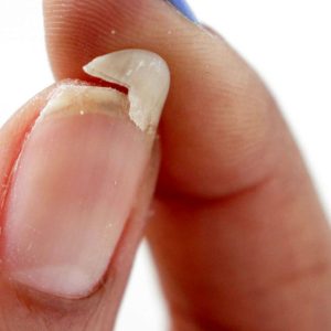 یگانیل - دوره آموزشی تخصصی ترمیم آسیب های ناخن - یگانه گودرزی